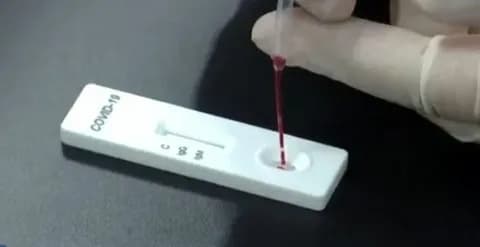 Yeni Hızlı Test Ölümcül Enfeksiyonları Sadece 15 Dakikada Tespit Ediyor — Исследователи из Университета штата Аризона (США) представили диагностический инструмент, который позволяет очень быстро установить диагноз таких заболеваний, как COVID-19, геморрагическая лихорадка Эбола или болезнь Лайма / © Arizona State University