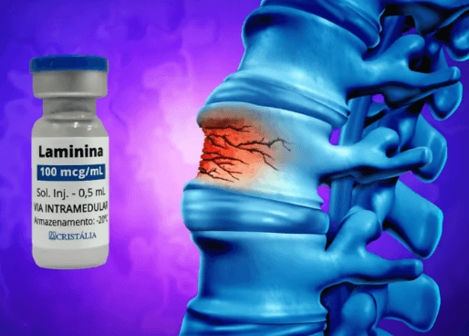 Clinical Breakthrough: ANVISA Approves Human Trials for Spinal Cord Repair