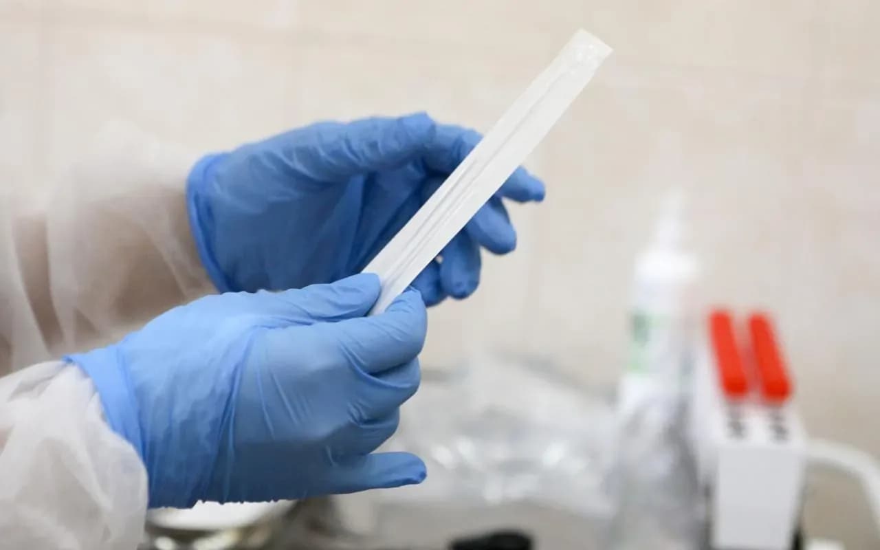 Russiýa Türkmenistana Ebolany anyklaýjy täze test-ulgamlaryny gowşurdy