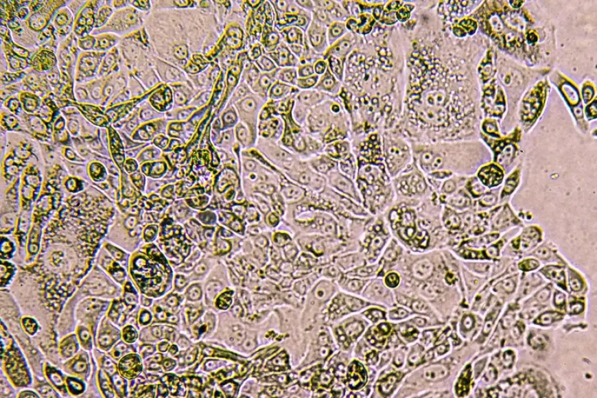 American Scientists Synthesized a Substance That Destroys Cancer Cells