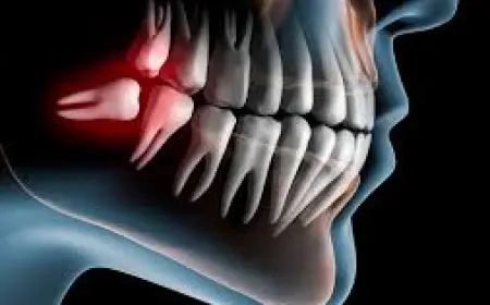 Japanese Scientists Develop Drug to Regrow Natural Teeth