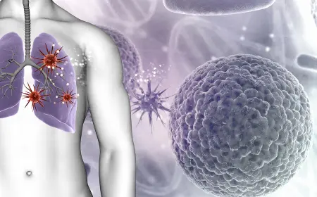 Lukman öýken ragynyň iň köp duş gelýän howp toparyndaky adamyň keşbini gürrüň berdi