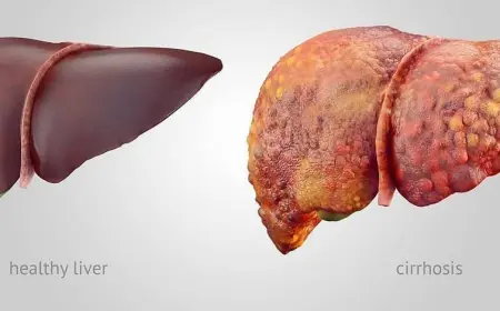 Открыт неожиданный способ борьбы с раком печени: популярный препарат показал эффективность
