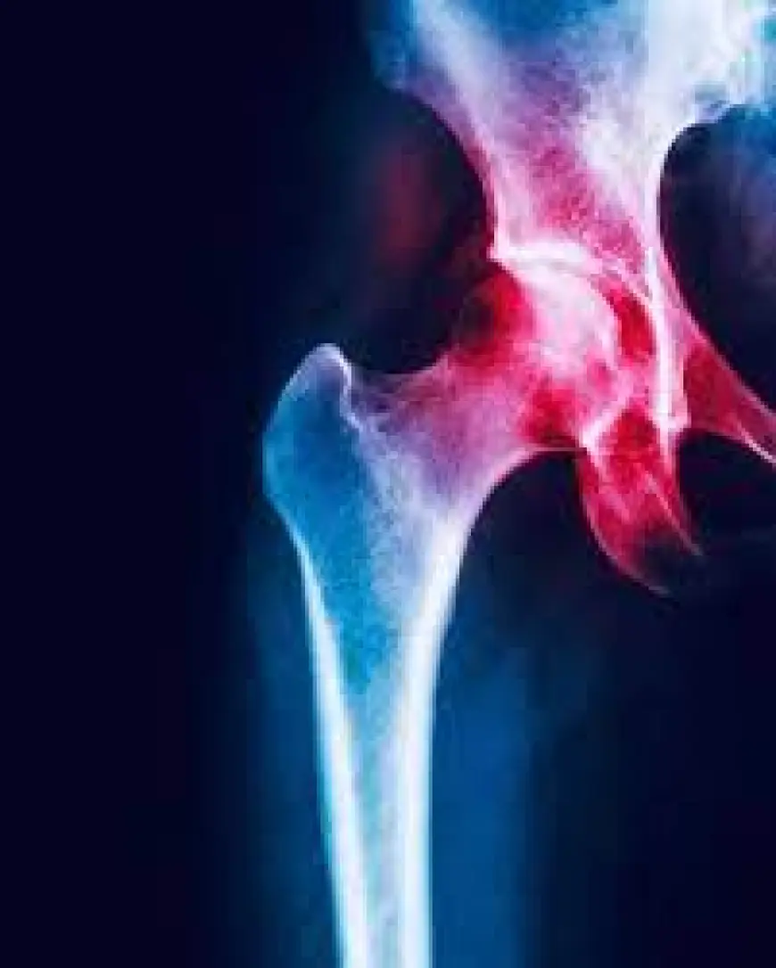 COVID‑19’dan keyin suyak ogʻriqlari va osteonekroz: sabablar, diagnostika, davolash va oldini olish