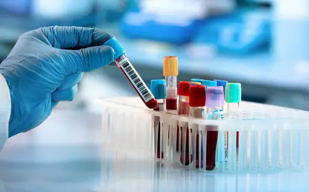 Учёные раскрыли, как клетки рака крови скрываются от иммунной системы