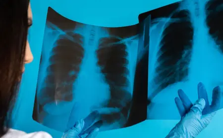 Врач назвал три группы людей с высоким риском рака лёгких