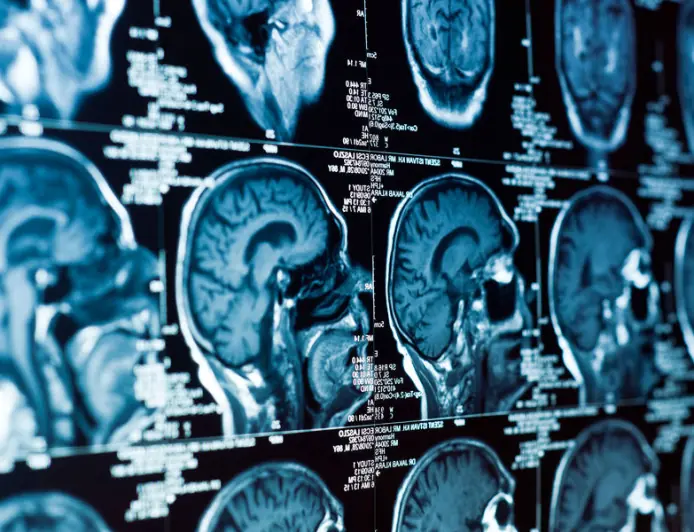 Учёные выяснили, почему мозг «тормозит» после бессонной ночи