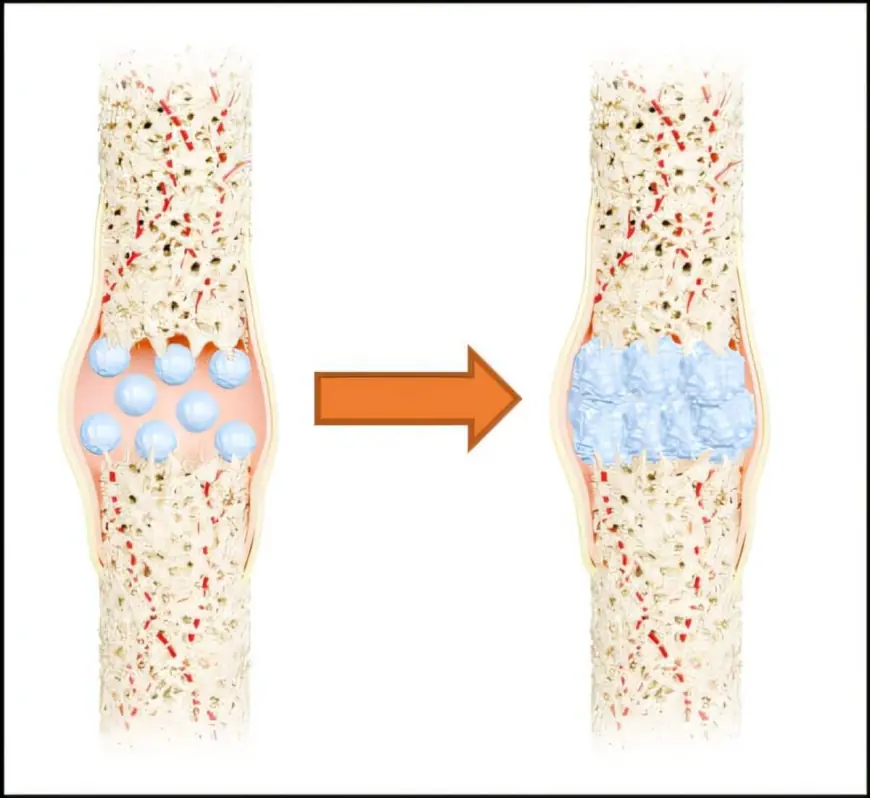 Scientists Develop Strong and Flexible Material for Bone Repair