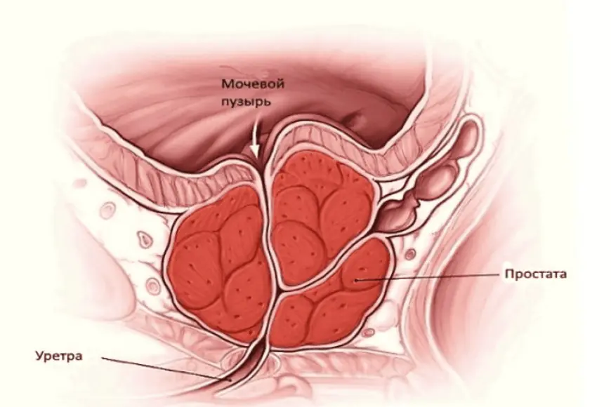 Scientists Discover a Way to “Turn Off” Prostate Cancer Genes