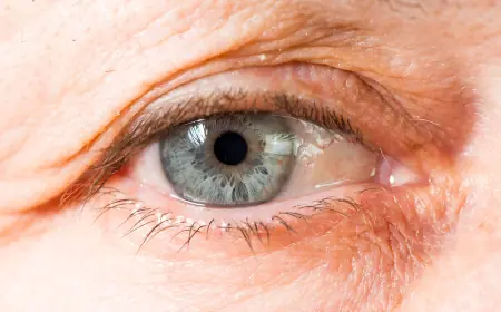 Dr. Kazantseva: Retinal prosthesis can restore vision in three cases