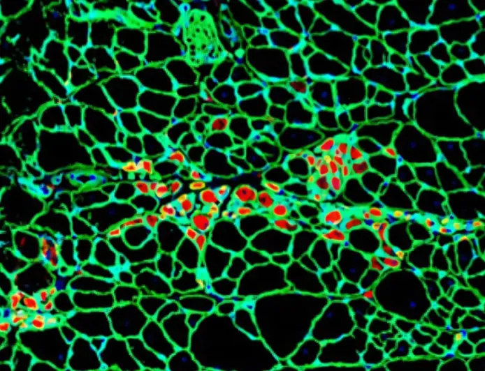 Найден эффективный способ борьбы с возрастным набором веса