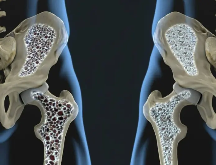 Alymlar: süňkleriň öz-özüni dikeltmegine ýardam berip biljek usuluny tapdylar