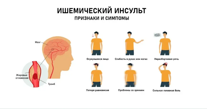 Protecting Your Brain from Stroke Through Healthy Eating