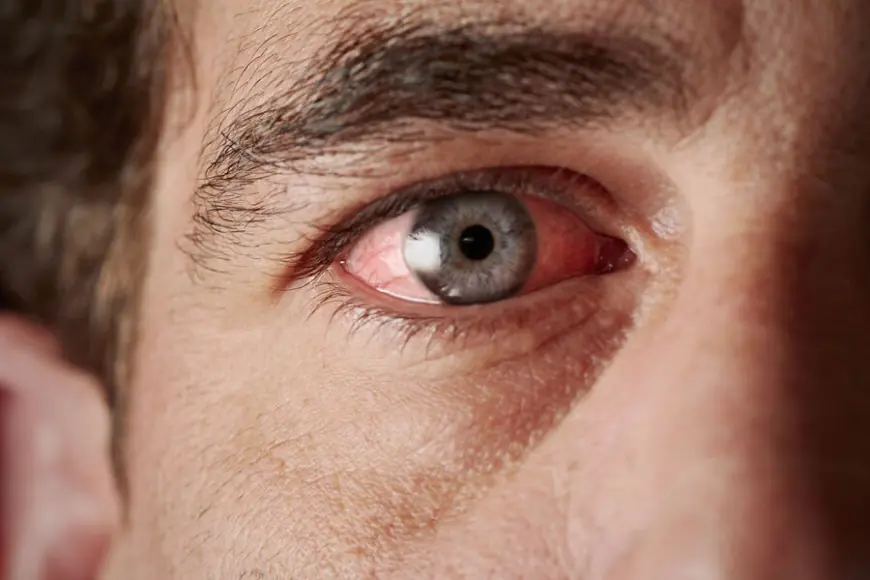 Lukman garry adamlarda näme üçin gözleriň ýaşarýandygyny düşündirdi