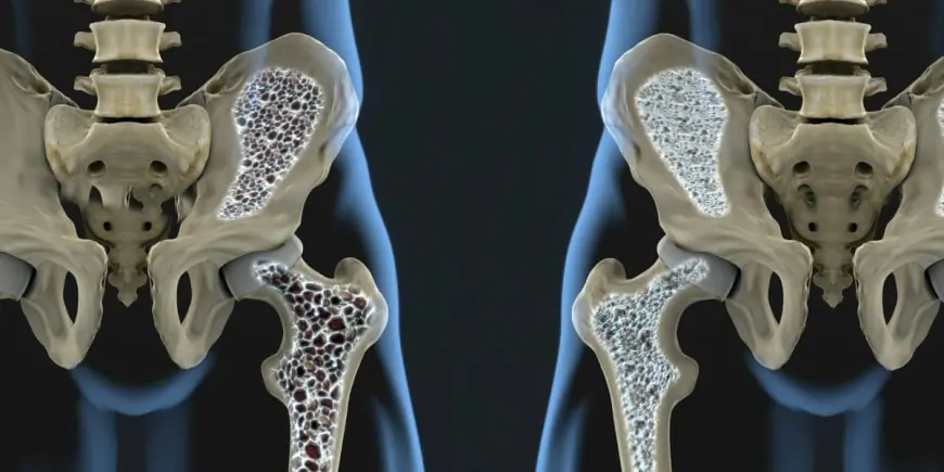 Alymlar: süňkleriň öz-özüni dikeltmegine ýardam berip biljek usuluny tapdylar